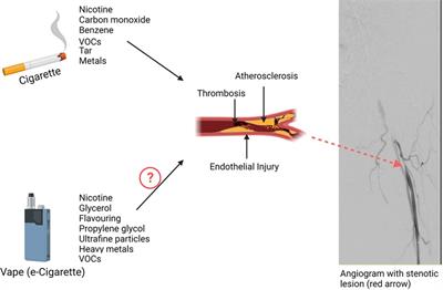 A modern day perspective on smoking in peripheral artery disease